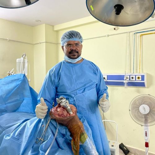 Knee Replacement Surgery Dr Madhu Reddy P Hyd Best Ortho